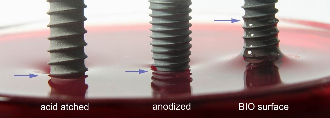 Vergleich der Benetzung mit Blut: acid etched, anodized und BIO-Oberfläche